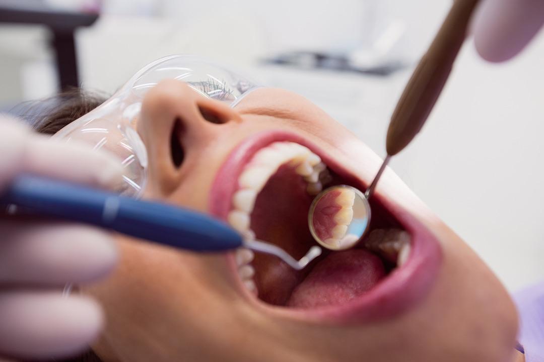 Periodontoloji
